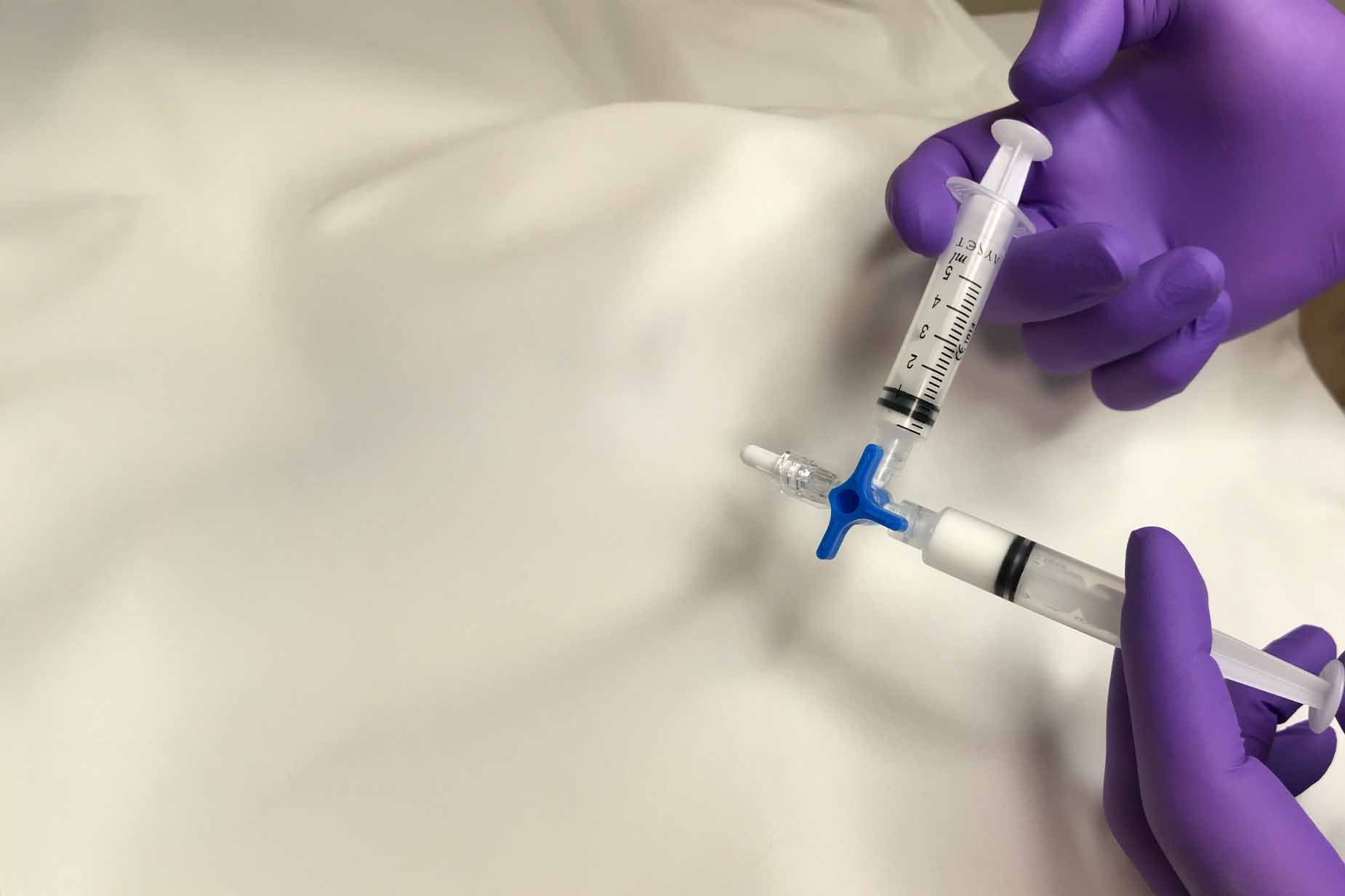 Köpük Skleroterapi